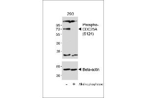Western blot analysis of lysates from 293 cell line, untreated or treated with Alkaline phosphatase, 1h, using 459088102 A (upper) or Beta-actin (lower).