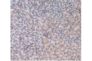 IHC-P analysis of Rat Adrenal Gland Tissue, with DAB staining. (ORM1 anticorps  (AA 19-186))