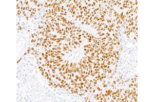 Immunohistochemistry (IHC) image for anti-MutS Homolog 6 (E. Coli) (MSH6) (AA 1310-1360) antibody (ABIN7455152) (Recombinant MSH6 anticorps  (AA 1310-1360))