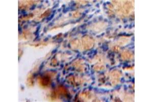 Used in DAB staining on fromalin fixed paraffin-embedded Bowels tissue (TGFB1I1 anticorps  (AA 256-461))