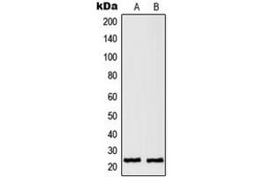 Western blot analysis of RAN expression in HeLa (A), A431 (B) whole cell lysates. (RAN anticorps  (C-Term))
