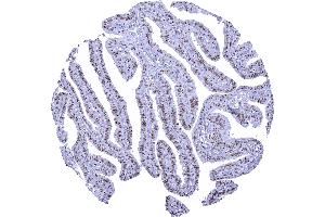 Fallopian tube mucosa The entire nuclei of epithelial cells are nucleolin positive but the immunostaining is most distinct in the nucleolus