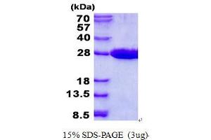 Image no. 1 for Mitochondrial Ribosome Recycling Factor (MRRF) protein (His tag) (ABIN1098467)