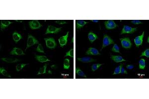 ICC/IF Image RRM2 antibody [N1C1] detects RRM2 protein at cytoplasm by immunofluorescent analysis. (RRM2 anticorps  (Regulatory Subunit))