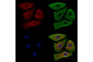 ABIN6263476 and ABIN6278962 staining Hela cells by IF/ICC.