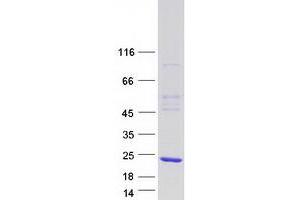 Validation with Western Blot