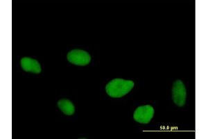 Immunofluorescence of purified MaxPab antibody to FLJ10826 on HeLa cell. (OGFOD1 anticorps  (AA 1-542))