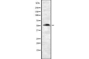 Western blot analysis of P4HTM using Jurkat whole cell lysates (P4HTM anticorps  (Internal Region))