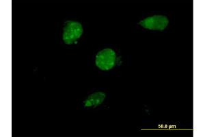 Immunofluorescence of monoclonal antibody to TSC22D4 on HeLa cell. (TSC22D4 anticorps  (AA 1-395))