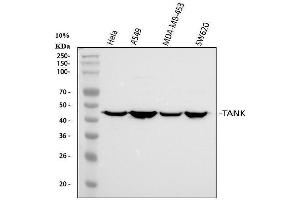 Western blot analysis of TANK using anti-TANK antibody (ABIN6719508). (TANK anticorps)