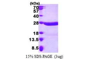 SDS-PAGE (SDS) image for Crystallin, beta A4 (CRYbA4) (AA 1-196) protein (His tag) (ABIN667521)