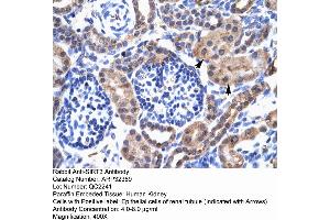 Human kidney (SIRT3 anticorps  (C-Term))