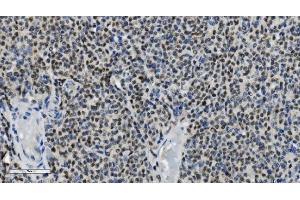 IHC analysis of PARP using anti-PARP antibody (ABIN7602278). (PARP1 anticorps  (AA 670-858))