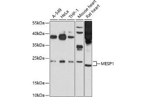 anti-Mesoderm Posterior 1 (MESP1) (AA 149-268) antibody