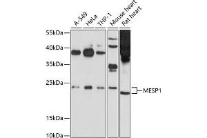 Western blot analysis of extracts of various cell lines, using MESP1 antibody (ABIN6131056, ABIN6143747, ABIN6143748 and ABIN6214298) at 1:1000 dilution. (MESP1 anticorps  (AA 149-268))
