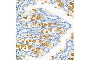 Immunohistochemistry of paraffin embedded mouse colon using CNTROB (ABIN7073427) at dilution of 1:200 (400x lens)