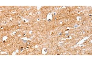 Immunohistochemistry of paraffin-embedded Human brain tissue using S100B Polyclonal Antibody at dilution 1:50 (S100B anticorps)