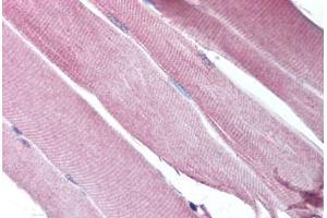 Human Skeletal Muscle (formalin-fixed, paraffin-embedded) stained with CHRND antibody ABIN213757 at 5 ug/ml followed by biotinylated goat anti-rabbit IgG secondary antibody ABIN481713, alkaline phosphatase-streptavidin and chromogen. (CHRND anticorps  (N-Term))