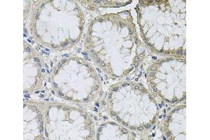 Immunohistochemistry of paraffin-embedded Human stomach using BCL2L2 Polyclonal Antibody at dilution of 1:100 (40x lens). (BCL2L2 anticorps)
