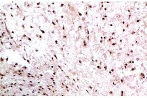 Immunohistochemistry of paraffin-embedded Human colon carcinoma tissue using CBX3 Monoclonal Antibody at dilution of 1:200. (CBX3 anticorps)