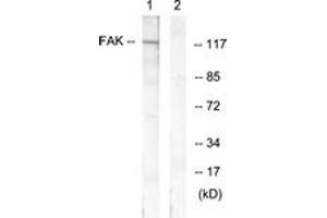 Western blot analysis of extracts from HeLa cells, treated with EGF 200ng/ml 30', using FAK (Ab-407) Antibody. (FAK anticorps  (AA 373-422))