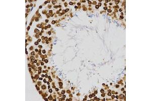 Immunohistochemistry of paraffin-embedded rat testis using TriMethyl-Histone H4-K20 antibody.