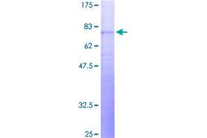 Image no. 1 for Neuropeptide Y Receptor Y5 (NPY5R) (AA 1-445) protein (GST tag) (ABIN7565559)