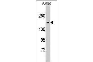 Western blot analysis of EPRS polyclonal antibody  in Jurkat cell line lysates (35 ug/lane). (EPRS anticorps  (N-Term))