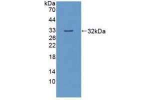 HMBS Antikörper  (AA 85-337)