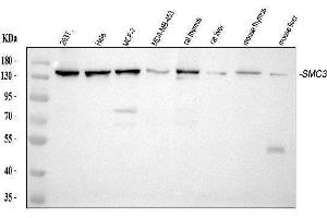 Western blot analysis of SMC3 using anti-SMC3 antibody (ABIN5693037).