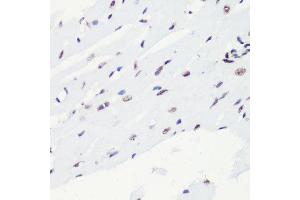 Immunohistochemistry of paraffin-embedded rat heart using H4K20me2 antibody.