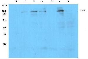 Detection of NR in protein extracts from leaves of Columbia (1) and NR knockout(2-3) mutants of Arabidopsis thaliana.