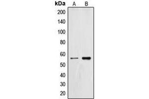 Western blot analysis of ZNF187 expression in HL60 (A), SP2/0 (B) whole cell lysates.