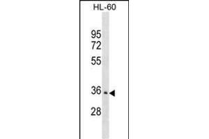 PDLIM3 Antibody (C-term) (ABIN1537141 and ABIN2850272) western blot analysis in HL-60 cell line lysates (35 μg/lane).