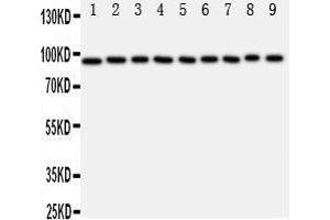 Western Blotting (WB) image for anti-Signal Transducer and Activator of Transcription 6, Interleukin-4 Induced (STAT6) (AA 13-29), (N-Term) antibody (ABIN3044265)