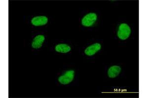 Immunofluorescence of purified MaxPab antibody to CDK7 on HeLa cell. (CDK7 anticorps  (AA 1-346))