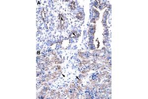 Immunohistochemical staining (Formalin-fixed paraffin-embedded sections) of human lung (A) and human liver (B) with HTATIP2 polyclonal antibody  at 4-8 ug/mL working concentration. (HIV-1 Tat Interactive Protein 2, 30kDa (HTATIP2) (N-Term) anticorps)