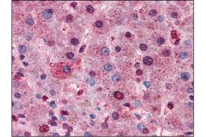 AP22624PU-N AKT antibody staining of Formalin-Fixed Paraffin-Embedded Human Liver at 1/100 followed by Biotin conjugated Goat anti-Rabbit IgG secondary antibody, Alkaline Phosphatase-Streptavidin and Chromogen. (AKT1 anticorps  (C-Term))