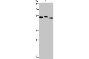 Western Blotting (WB) image for anti-Hyaluronidase-3 (HYAL3) antibody (ABIN2423631) (HYAL3 anticorps)