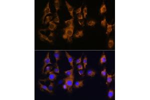 Immunofluorescence analysis of C6 using SPRR3 antibody (ABIN6130714, ABIN6148386, ABIN6148387 and ABIN6215609) at dilution of 1:100 (40x lens). (SPRR3 anticorps  (AA 1-70))