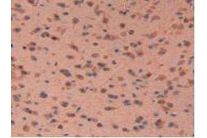 IHC-P analysis of Mouse Brain Tissue, with DAB staining. (LIFR anticorps  (AA 381-485))