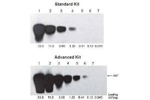 Two similar blots were processed with the same procedures using different ONE-HOUR WesternTM Kits: Standard (ABIN491508) and Advanced (ABIN491500). (ONE-HOUR Western Basic Kit (Souris))