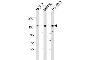 All lanes : Anti-SRG Antibody (C-term) at 1:2000 dilution Lane 1: MCF-7 whole cell lysate Lane 2: S whole cell lysate Lane 3: SH-SY5Y whole cell lysate Lysates/proteins at 20 μg per lane. (SRGAP2 anticorps  (C-Term))