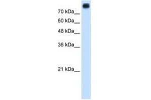 Image no. 2 for anti-P-Cadherin (CDH3) (AA 187-236) antibody (ABIN205074) (P-Cadherin anticorps  (AA 187-236))