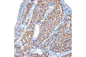 Immunohistochemistry of paraffin-embedded rat ovary using HSD3B1 Rabbit mAb (ABIN7267801) at dilution of 1:100 (40x lens).