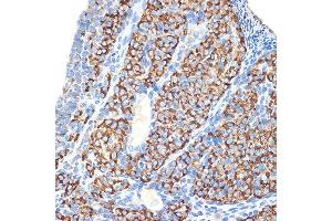 Immunohistochemistry of paraffin-embedded rat ovary using HSD3B1 Rabbit mAb (ABIN7267801) at dilution of 1:100 (40x lens). (HSD3B1 anticorps)