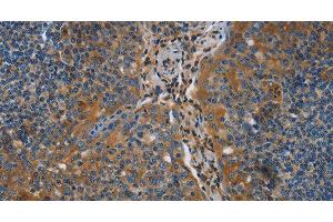 Immunohistochemistry of paraffin-embedded Human tonsil using NRN1 Polyclonal Antibody at dilution of 1:40 (NRN1 anticorps)