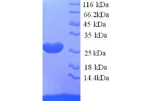 Ephrin A5 (EFNA5) (AA 21-203), (full length) protein (His tag)