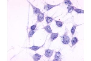 Anti-P2RY6 / P2Y6 antibody immunocytochemistry (ICC) staining of untransfected HEK293 human embryonic kidney cells.