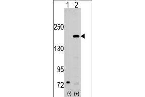 Western blot analysis of SRC1 (arrow) using rabbit NCOA1 polyclonal antibody . (NCOA1 anticorps  (N-Term))